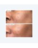111Skin 111Skin Precision Peel - 8