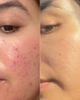 Aramore Skincare Aramore Skincare NAD+ Renew & Restore Bundle - 3