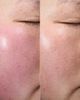 Aramore Skincare Aramore Skincare NAD+ Renew & Restore Bundle - 4