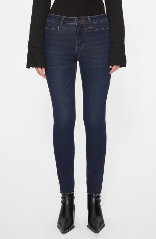Bayeas Bayeas Yoyo Skinny Jeans