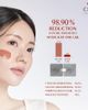 Candorlov Candorlov Clay Mask Sensitive Skin Deep Pore Cleansing Exfoliating Facial Care 2.7 oz - 2