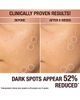 Charlotte Tilbury Charlotte Tilbury Dark Spot Correcting Radiance Recovery Serum 10ml - 2