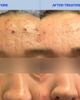 Codex Labs Codex Labs SHAANT Pore Purifying Acne Face Scrub - 2