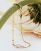Daisy London Daisy London Healing Bracelet - 1