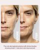 DERMAFLASH DERMAFLASH LUXE+ Anti-Aging Sonic Dermaplaning + Peach Fuzz Removal Set - 5