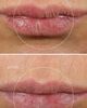 Dr. Marnie Dr. Marnie Lip Serum Clear 0.1 oz/3.7 - 4