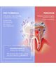 FOREO FOREO issa Dual LED + Sonic Teeth Whitening Device - 4