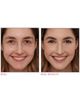 IT Cosmetics IT Cosmetics Your Skin But Better CC+ Airbrush Perfecting Powder - 3