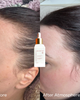 Luna Nectar Luna Nectar Atmosphere Multi-Peptide Hair Density & Scalp Serum - 5