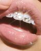Never Have I Ever Never Have I Ever DIY Tooth Gem Kit in Bow Baby at Urban Outfitters - 4