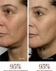 NuFACE® NuFACE® MINI+ Smart Petite Microcurrent Facial Toning Device Starter Kit - 5
