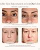 Project E Beauty Project E Beauty Lumamask Pro LED Light Therapy Face Mask - 3