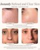 Project E Beauty Project E Beauty Reinvo Facial Microdermabrasion Wand - 3