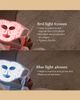 Silk'N Silk'N LED Face Mask - 4