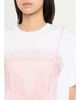 Simone Rocha Slip Dress Trompe L'oeil Print Short-Sleeve T-Shirt - 5