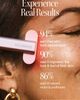 SolaWave SolaWave 4-in-1 Red Light Skin Care Wand Set (Nordstrom Exclusive) - 2