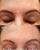 SolaWave SolaWave 4-in-1 Skin Care Wand - 4