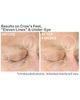 StriVectin® StriVectin® Anti-Wrinkle - 4