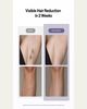 Ulike Air 10 Ice Cooling IPL Hair Removal Device - 4