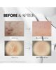 VT COSMETICS VT COSMETICS Reedle Shot­™ 100 - 4