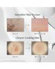VT COSMETICS VT COSMETICS Reedle Shot™ 700 - 3