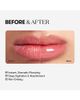 VT COSMETICS VT COSMETICS Reedle Shot Lip Plumper Expert - 3